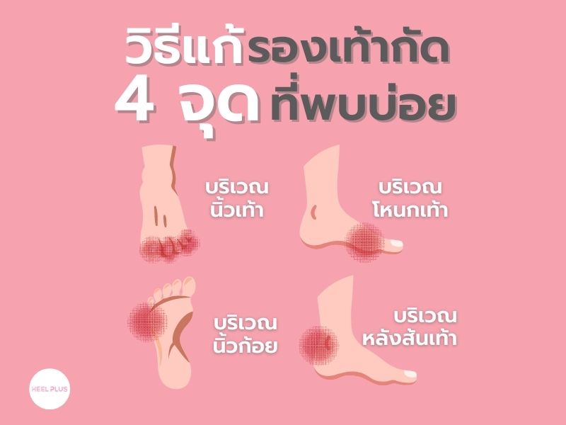 วิธีแก้ปัญหารองเท้ากัด 4 จุด ที่พบบ่อย