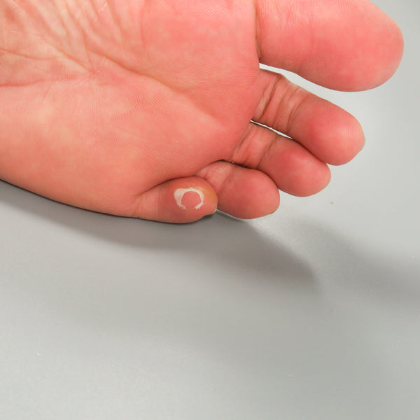 ซิลิโคนคั่นนิ้ว แบบรองหน้าเท้า No.56 - Silicone Toe Cushioning