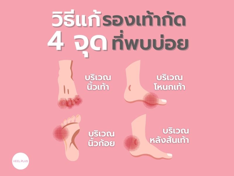 วิธีแก้ปัญหารองเท้ากัด 4 จุด ที่พบบ่อย