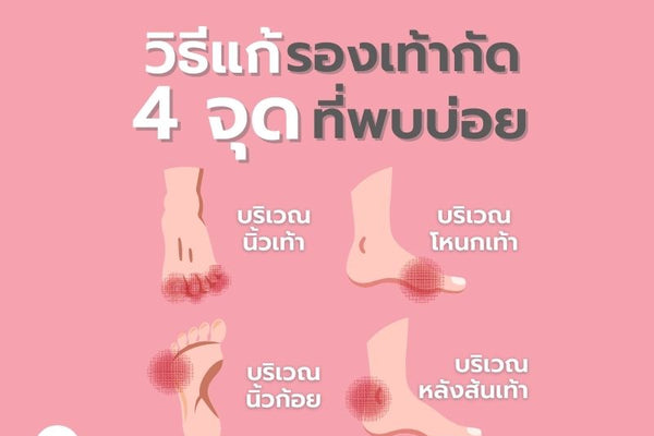 วิธีแก้ปัญหารองเท้ากัด 4 จุด ที่พบบ่อย